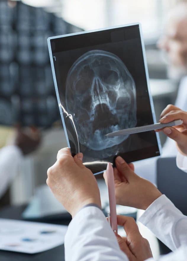 Traumatic Brain Injuries